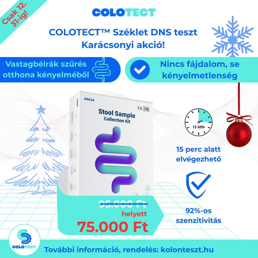 kolonteszt_karacsonyi_akcio_mobilteelfon_verzio